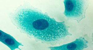 ¿Saludable la Vitamina C? Estudio revela que estimula las células cancerígenas