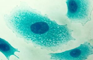 ¿Saludable la Vitamina C? Estudio revela que estimula las células cancerígenas