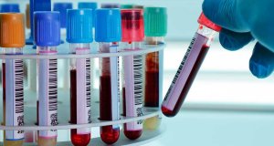 ¿Tu sangre es tipo A?… pues corres más riesgo de contraer coronavirus