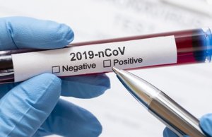 Afecta Covid-19 al menos a 20 funcionarios del gobierno de Sinaloa