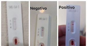 Test rápidos para diagnóstico de Covid-19, son un peligro y no están permitidos: Coepriss