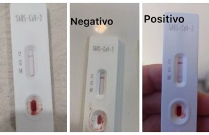 Test rápidos para diagnóstico de Covid-19, son un peligro y no están permitidos: Coepriss