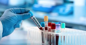 Productores sinaloenses de hortalizas, apoyan con pruebas diagnósticas a personal médico