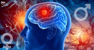 Hormonas sexuales podrían estimular crecimiento de tumores cerebrales