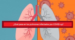 ¿Qué pasa en los pulmones cuando hay infección por COVID-19?