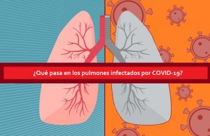 ¿Qué pasa en los pulmones cuando hay infección por COVID-19?