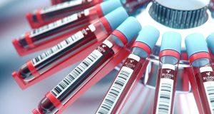 PanSeer, la prueba de sangre que detecta el cáncer 4 años antes de que se manifieste