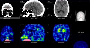 Analfabetismo emocional