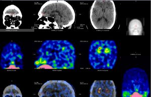 Analfabetismo emocional