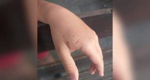 Pequeño se ven aprietos; el cierre de su shorts se atora y llama al 911