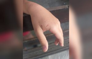 Pequeño se ven aprietos; el cierre de su shorts se atora y llama al 911