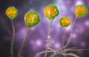 Registran primer caso de “hongo negro” en México; en un hombre del EdoMex