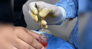 Donan córneas de su hijo; el joven murió luego de accidentarse vacacionando en Mazatlán