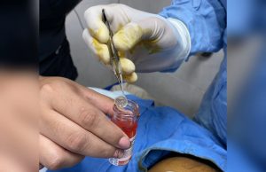 Donan córneas de su hijo; el joven murió luego de accidentarse vacacionando en Mazatlán