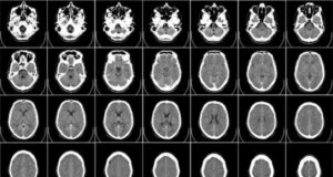 Origen de la conducta homicida