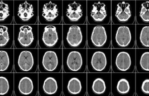 Origen de la conducta homicida