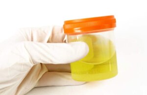 La orina humana podría contribuir a mejorar la tierra, entérate cómo