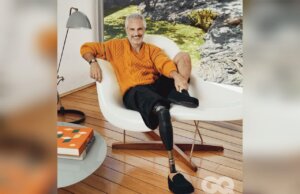 El actor Juan Pablo Medina comparte sus primeras fotos con prótesis, luego de trombosis