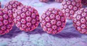 Cáncer Cérvico Uterino, 100% curable si se detecta a tiempo