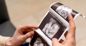 Prófugos del ácido fólico