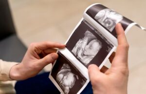 Prófugos del ácido fólico