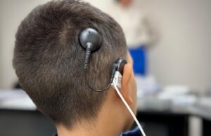 En Sinaloa se han colocado 59 implantes cocleares