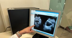 El cáncer de próstata, uno de los más comunes en el hombre; exámenes preventivos son claves