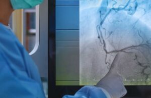 Doctorando de la UAS desarrolla método experimental a partir de imágenes de angiogramas para prevenir enfermedades cardiacas graves