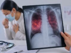 La tuberculosis es curable si se detecta y trata oportunamente
