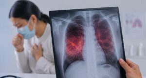 La tuberculosis es curable si se detecta y trata oportunamente